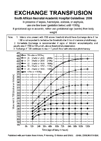 Exchange transfusion (paed ch19.9.1).png