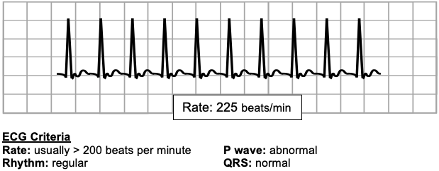 Supraventricular tachycardia