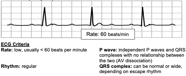 Heart block